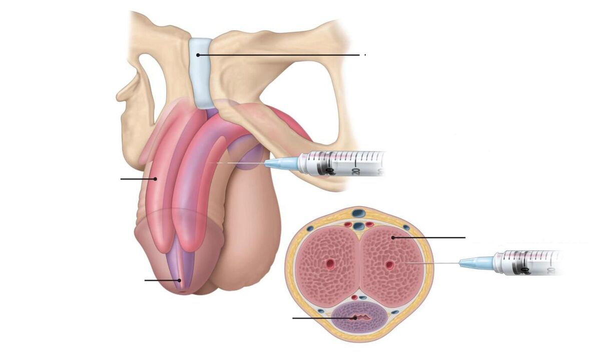 injection to increase potency